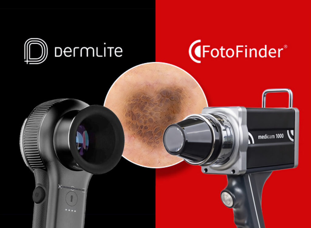 Fantástica noticia: FotoFinder dá as boas vindas à DermLite