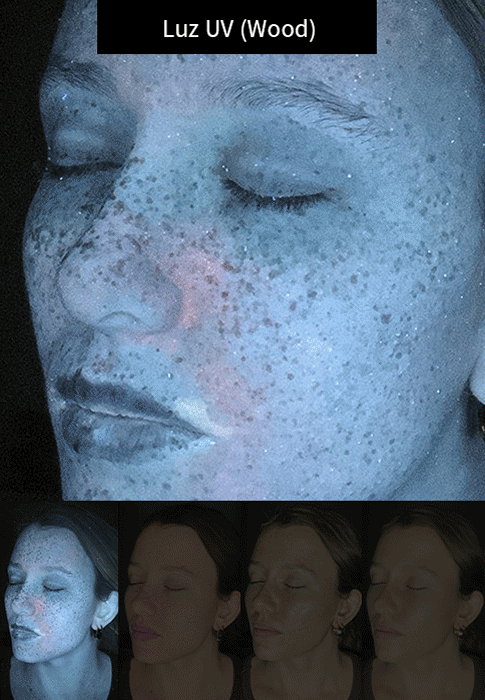 Imagem animada das 4 luzes disponíveis no dispositivo portátil para fotografias de dermatologia e estética.